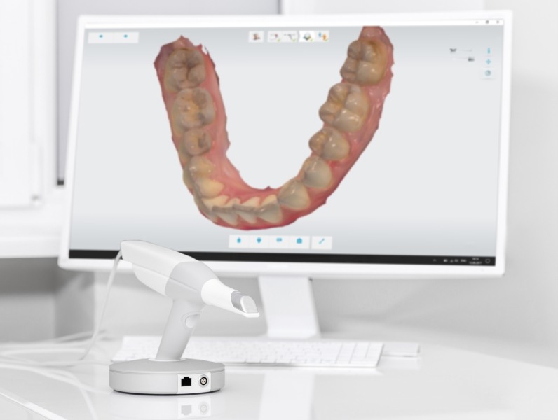 Digital model of a row of teeth on computer screen in dental office